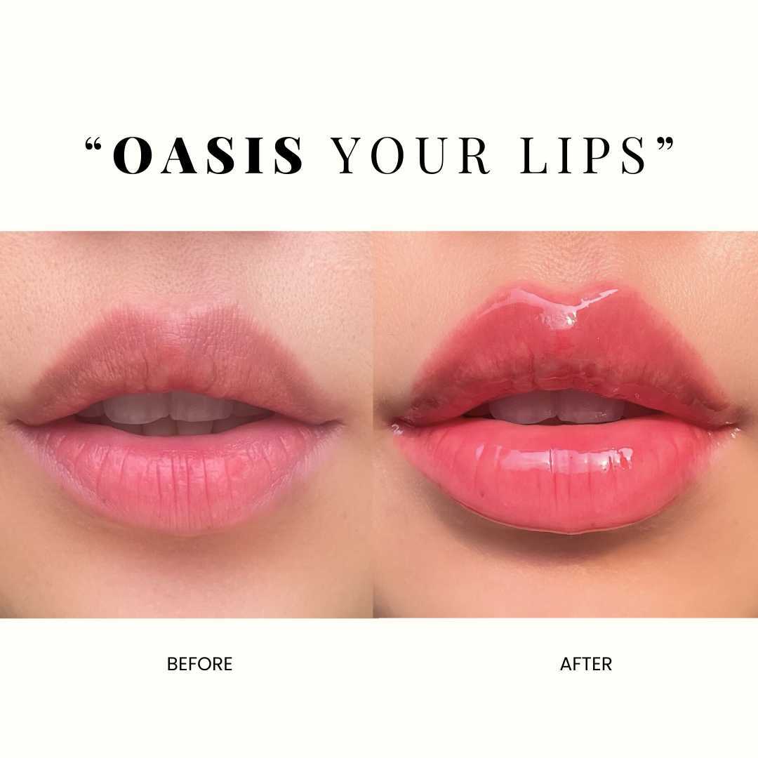 Oasis Lip Treatment
